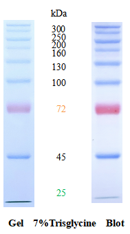 SDS-PAGE条带图谱