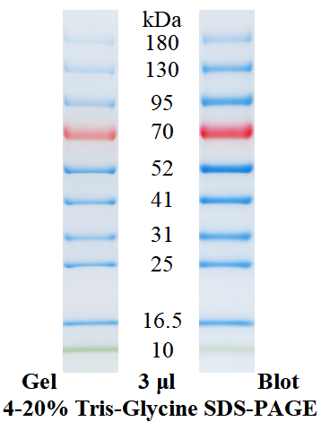 SDS-PAGE条带图谱